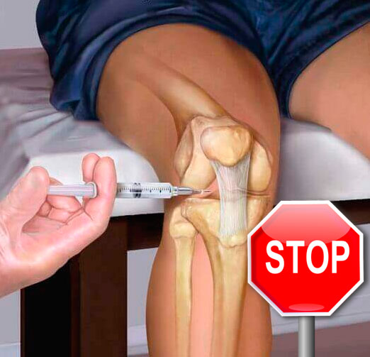 Лечение колена без операции
