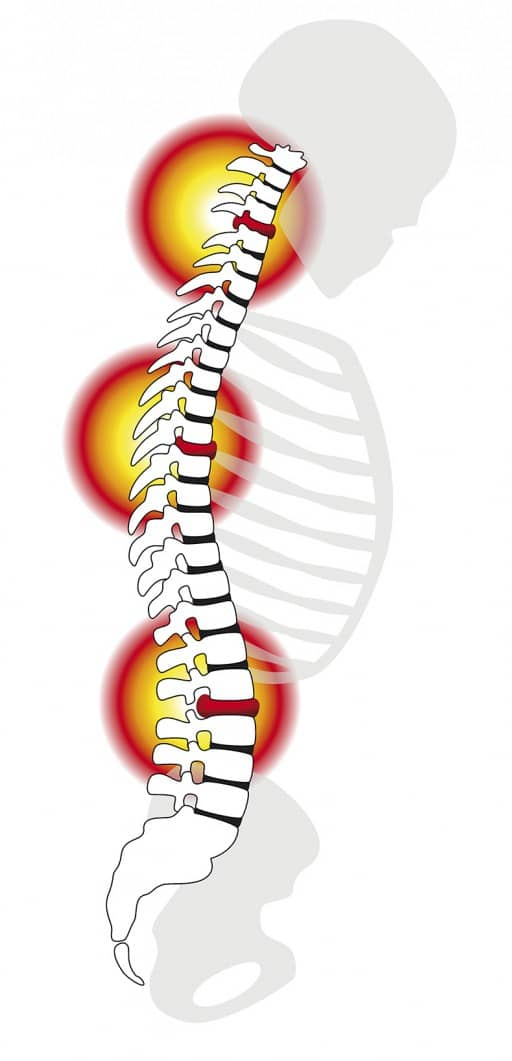 Диагностика заболеваний спины
