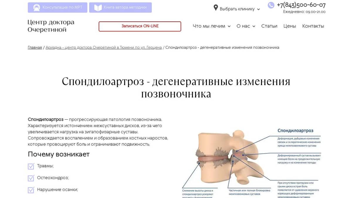 Спондилоартроз: симптомы и лечение | Диагностика спондилоартроза позвоночника в АО «Медицина»