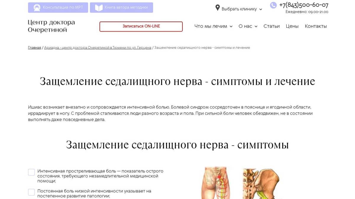 Мазь при защемлении нерва в пояснице. Боль в пояснице иррадиирует в ногу. Ишиас формулировка диагноза. Упражнения при защемлении седалищного нерва в ягодице и ноге слева.