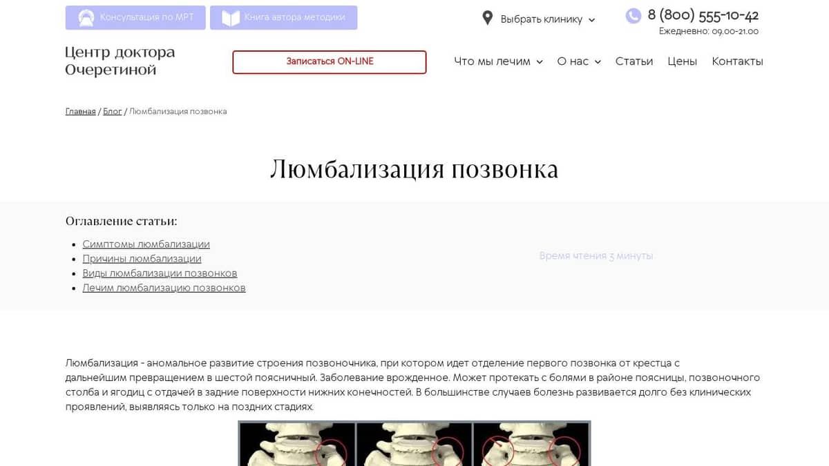 Люмбализация – причины, симптомы, диагностика и лечение | «СМ-Клиника»