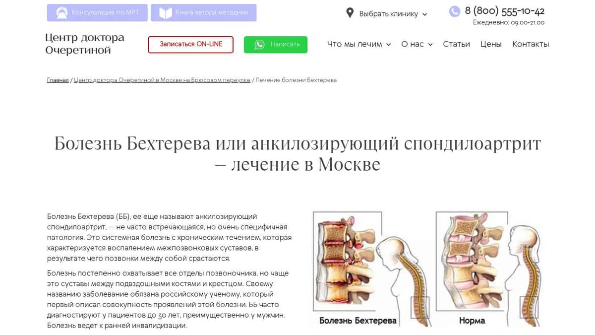 Болезнь Бехтерева — лечение без лекарств и операций в Москве