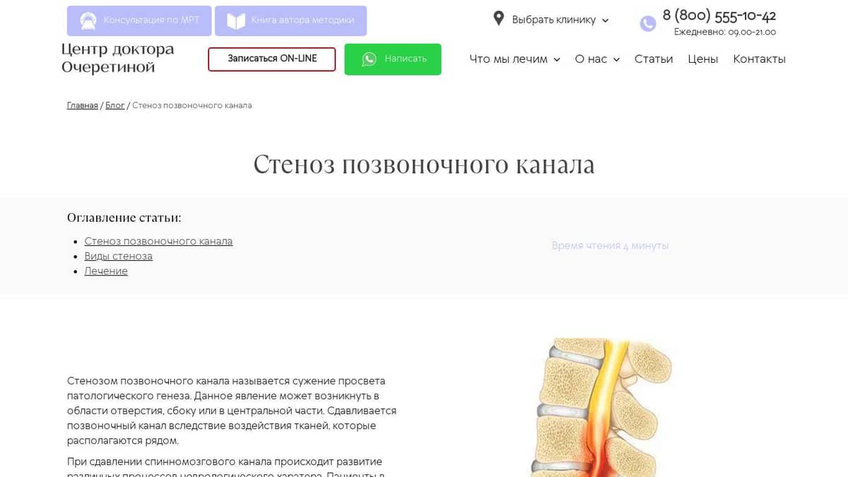 Стеноз позвоночного канала