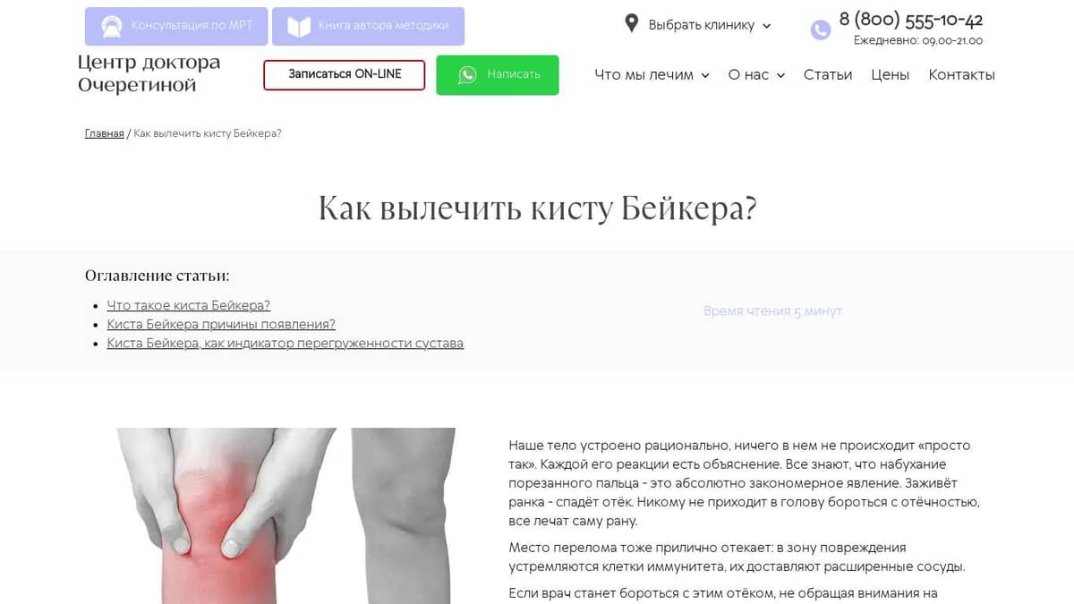 Киста Бейкера коленного сустава - Лечение без операции в Киеве | Чем опасна Киста Бейкера