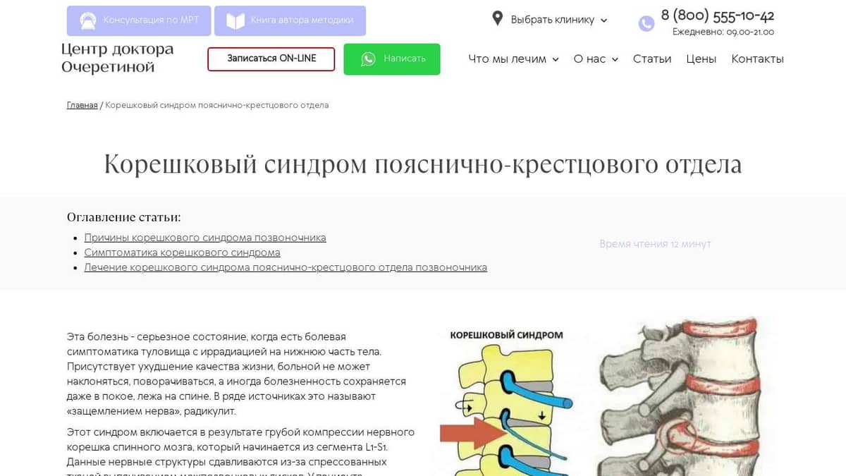 Корешковый синдром поясничного отдела позвоночника