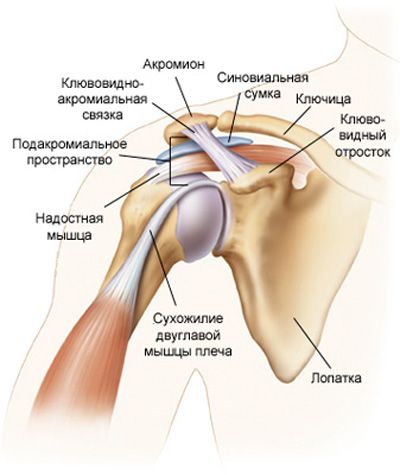 Плечевой периартрит