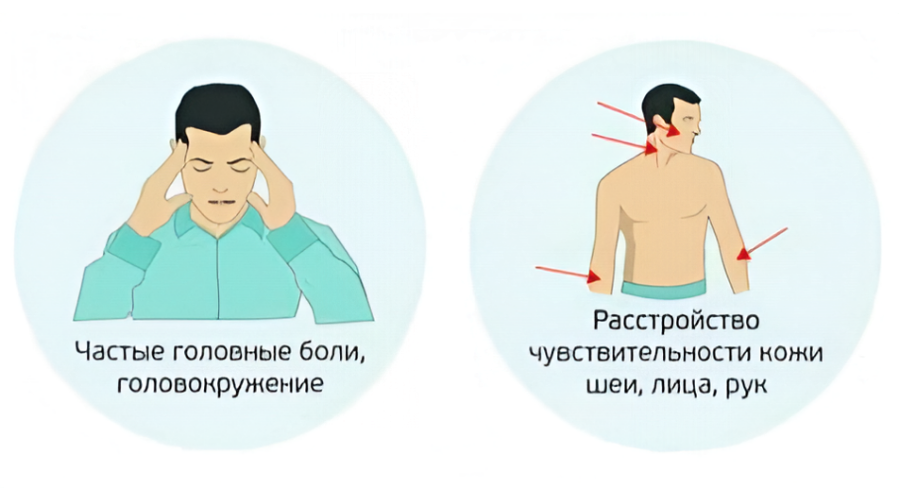 Остеохондроз шейно-грудного отдела, симптомы 